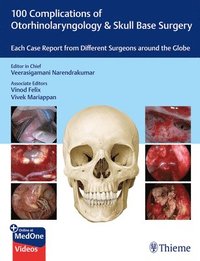bokomslag 100 Complications of Otorhinolangyngology & Skull Base Surgery: Each Case Report from Different Surgeons Around the Globe