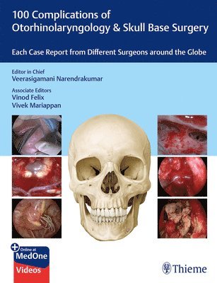 100 Complications of Otorhinolaryngology & Skull Base Surgery: Each Case Report from Different Surgeons Around the Globe 1