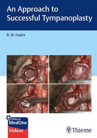 bokomslag An Approach to Successful Tympanoplasty