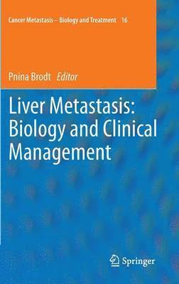 Liver Metastasis: Biology and Clinical Management