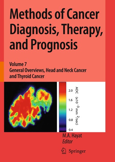 M. A. Hayat - Methods of Cancer Diagnosis, Therapy, and Prognosis, Häftad