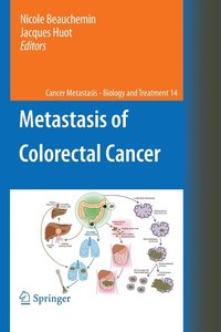 bokomslag Metastasis of Colorectal Cancer