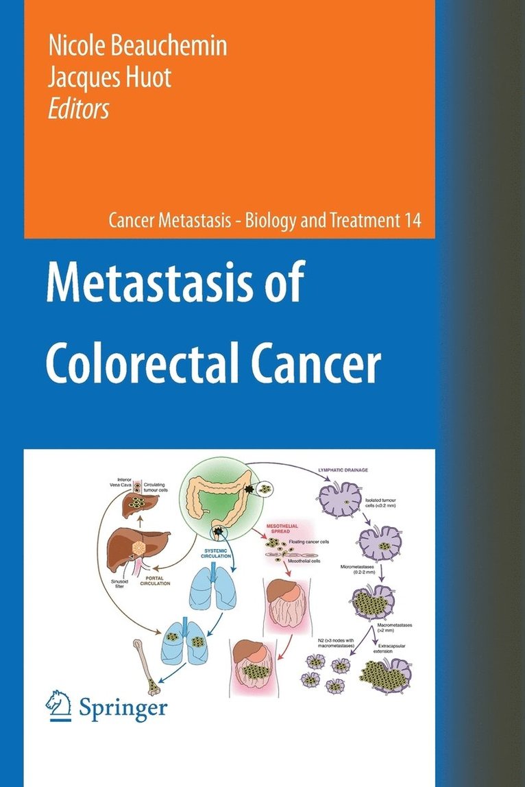 Metastasis of Colorectal Cancer 1