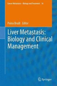 bokomslag Liver Metastasis: Biology and Clinical Management