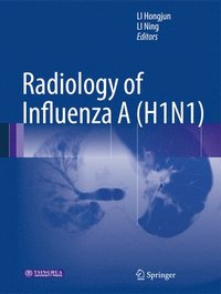 bokomslag Radiology of Influenza A (H1N1)