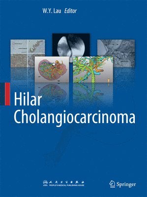 bokomslag Hilar Cholangiocarcinoma