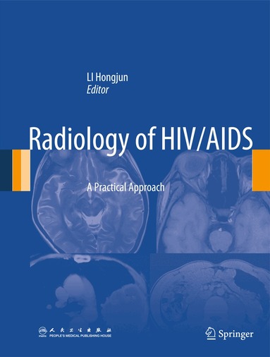 Hongjun Li - Radiology of HIV/AIDS, Inbunden