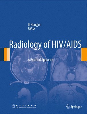 bokomslag Radiology of HIV/AIDS