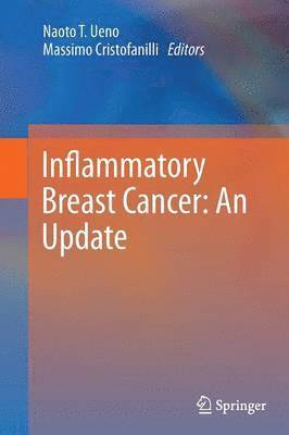 Naoto T. Ueno, Tamara Fink - Inflammatory Breast Cancer: An Update, Häftad