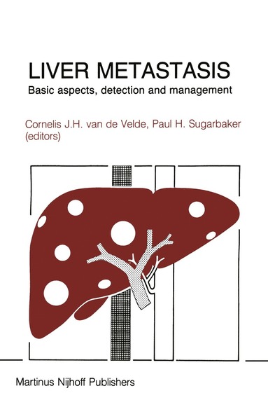 bokomslag Liver Metastasis