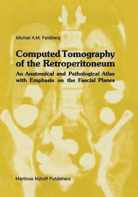 bokomslag Computed Tomography of the Retroperitoneum