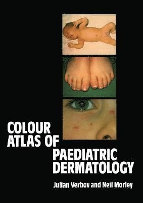 bokomslag Colour Atlas of Paediatric Dermatology