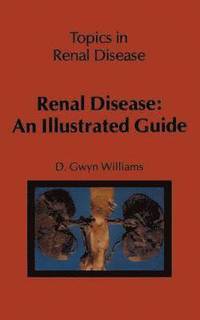 bokomslag Renal Disease: An Illustrated Guide