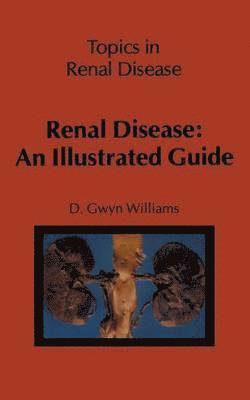 Renal Disease: An Illustrated Guide 1