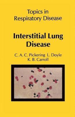 bokomslag Interstitial Lung Disease