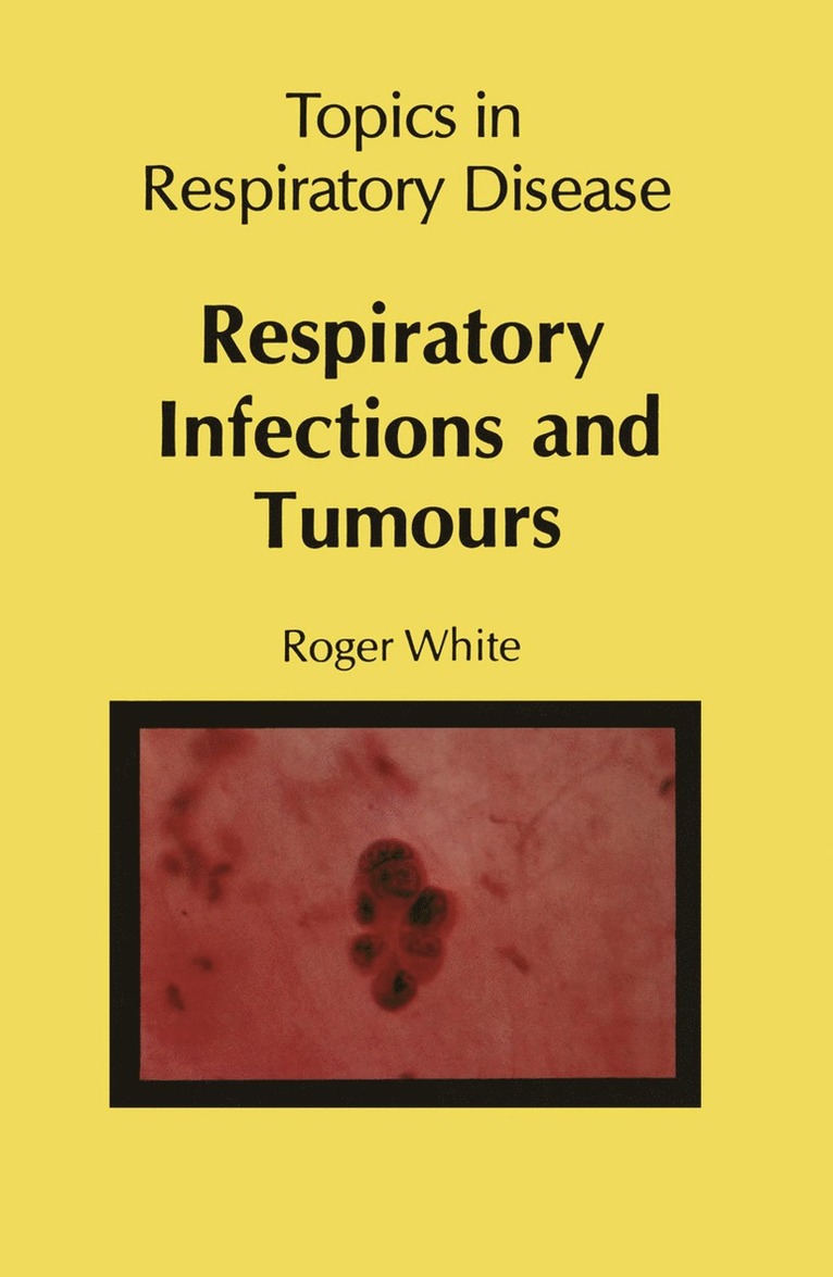 Respiratory Infections and Tumours 1