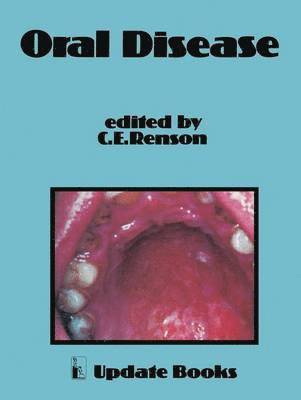 bokomslag Oral Disease