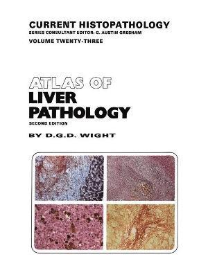 bokomslag Atlas of Liver Pathology