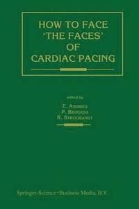 bokomslag How to face the faces of CARDIAC PACING