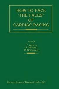 bokomslag How to face 'the faces' of CARDIAC PACING