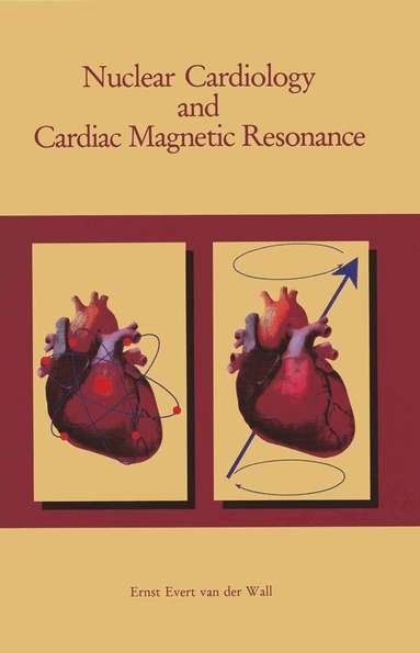 Ernst E. van der Wall - Nuclear Cardiology and Cardiac Magnetic Resonance, Häftad