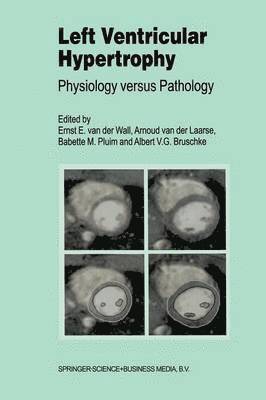 bokomslag Left Ventricular Hypertrophy