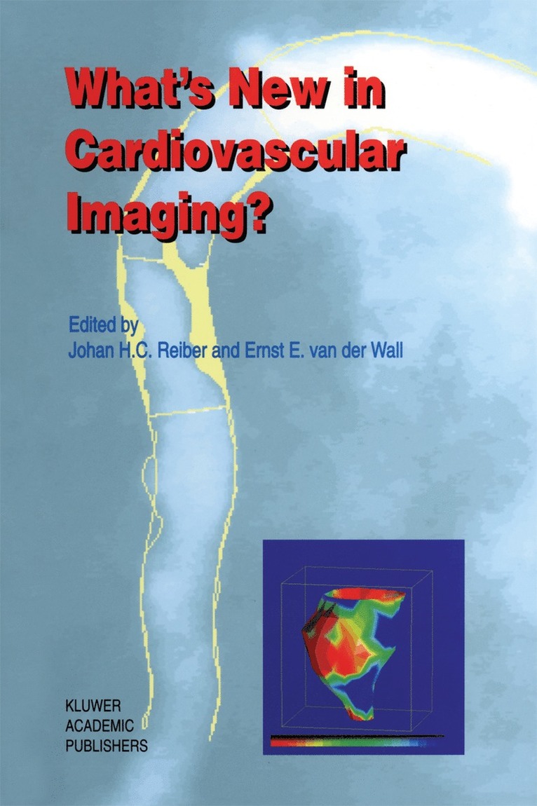 Johan H. C. Reiber, Ernst E. van der Wall, Ernst E. Van Der Wall, Ernst E. Van Der Wall - What’s New in Cardiovascular Imaging?, Häftad