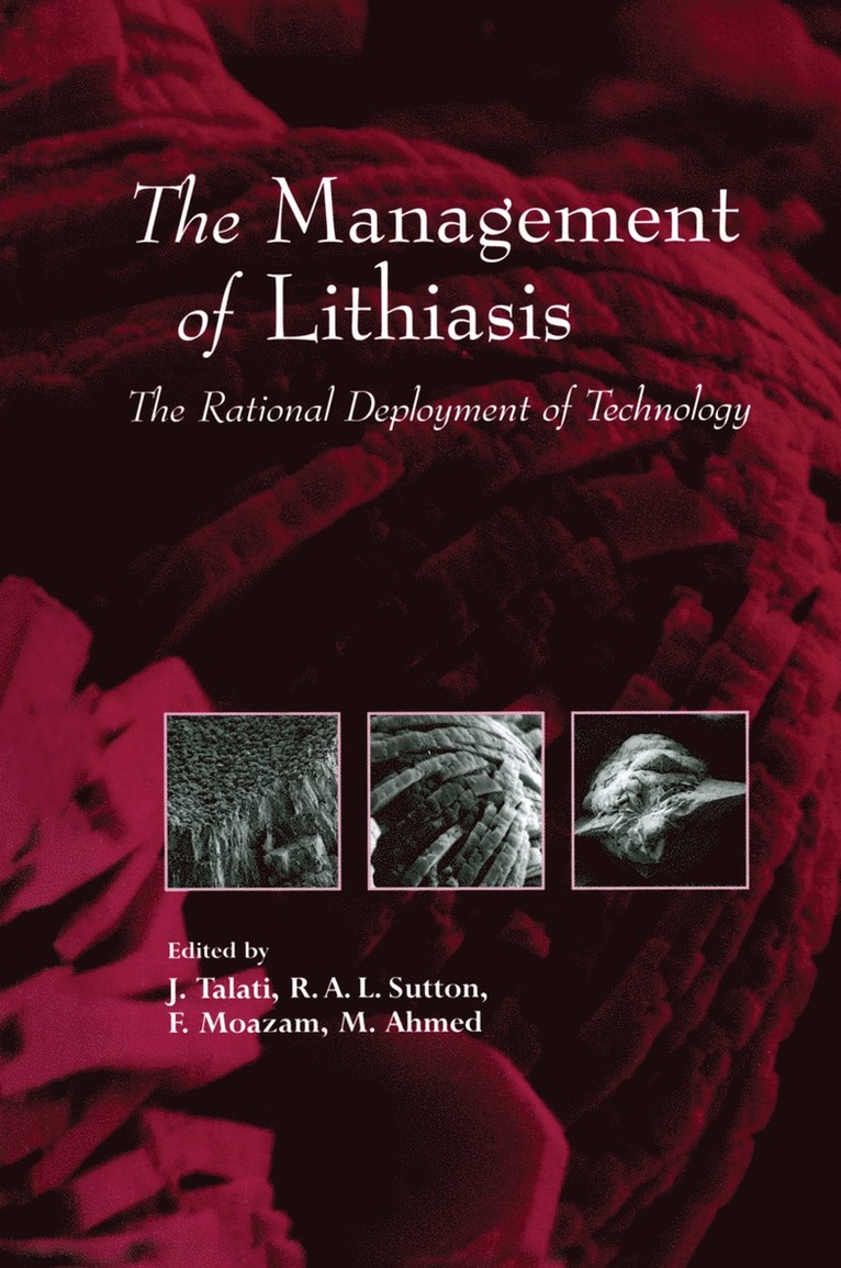 Jamsheer J. Talati, R.A.L. Sutton, F. Moazam, M. Ahmed, R. a. L. Sutton, R. A. L. Sutton - Management of Lithiasis, Häftad