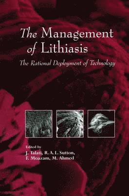 The Management of Lithiasis 1