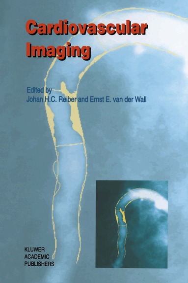 Johan H. C. Reiber, Ernst E. van der Wall - Cardiovascular Imaging, Häftad