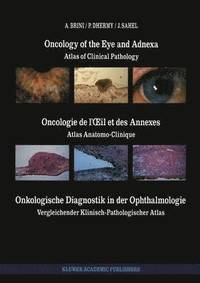 bokomslag Oncology of the Eye and Adnexa / Oncologie de lil et des Annexes / Onkologische Diagnostik in der Ophthalmologie