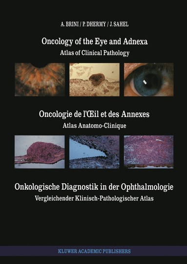 A. Brini, A. Dhermy, J. Sahel - Oncology of the Eye and Adnexa / Oncologie de l’Œil et des Annexes / Onkologische Diagnostik in der Ophthalmologie, Häftad