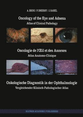 Oncology of the Eye and Adnexa / Oncologie de lil et des Annexes / Onkologische Diagnostik in der Ophthalmologie 1