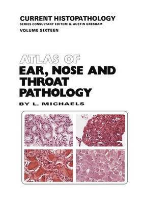 bokomslag Atlas of Ear, Nose and Throat Pathology