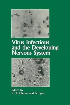 Virus Infections and the Developing Nervous System 1