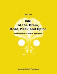 bokomslag MRI of the Brain, Head, Neck and Spine