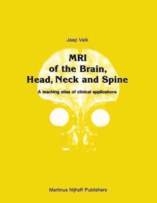 MRI of the Brain, Head, Neck and Spine 1