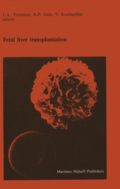 bokomslag Fetal liver transplantation