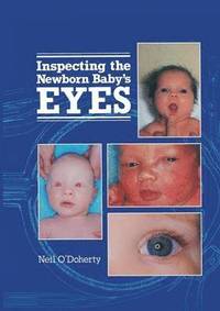 bokomslag Inspecting the Newborn Baby's Eyes