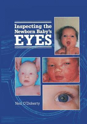 Inspecting the Newborn Baby's Eyes 1