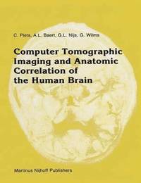 bokomslag Computer Tomographic Imaging and Anatomic Correlation of the Human Brain