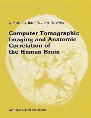 bokomslag Computer Tomographic Imaging and Anatomic Correlation of the Human Brain