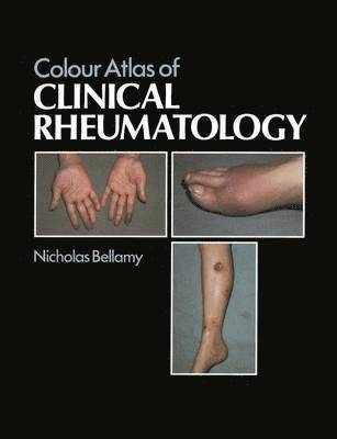 bokomslag Colour Atlas of Clinical Rheumatology