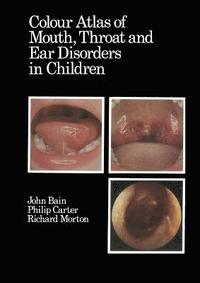 bokomslag Colour Atlas of Mouth, Throat and Ear Disorders in Children