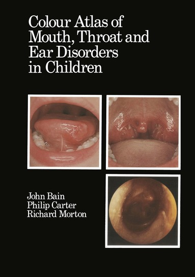 D.J. Bain, R.A. Morton, Philip Carter - Colour Atlas of Mouth, Throat and Ear Disorders in Children, Häftad