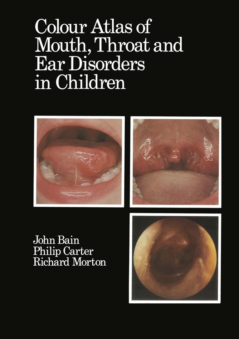 D.J. Bain, R.A. Morton, Philip Carter, D. J. Bain, R. a. Morton, R. A. Morton - Colour Atlas of Mouth, Throat and Ear Disorders in Children, Häftad