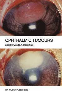 bokomslag Ophthalmic Tumours