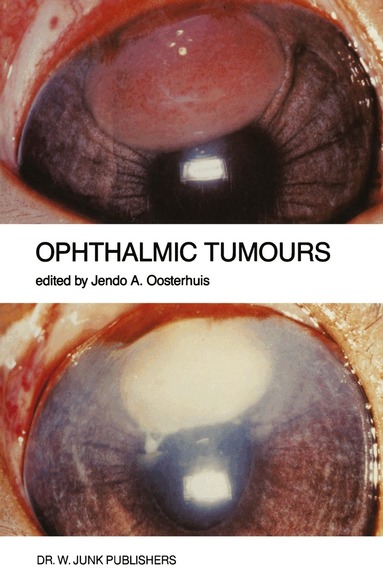 Jendo A. Oosterhuis - Ophthalmic Tumours, Häftad