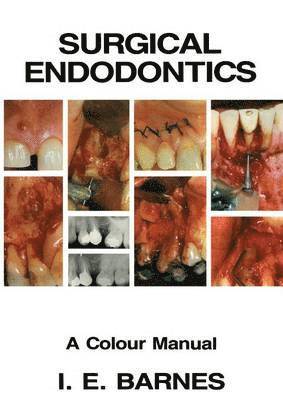 Surgical Endodontics 1