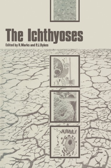 R. Marks, P.J. Dykes - Ichthyoses, Häftad